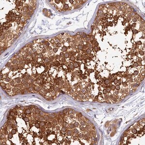 Merck Anti-PPIP5K1 antibody produced in rabbit