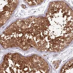 Merck Anti-PPIP5K1 antibody produced in rabbit