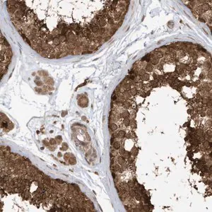 Merck Anti-DHX36 antibody produced in rabbit