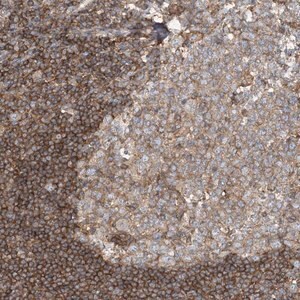 Merck Anti-SFMBT2 antibody produced in rabbit