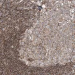 Merck Anti-SFMBT2 antibody produced in rabbit