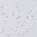 Merck Anti-RPF2 antibody produced in rabbit