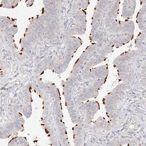 Merck Anti-TRANK1 antibody produced in rabbit