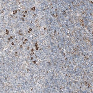 Merck Anti-CERKL antibody produced in rabbit