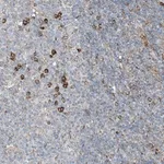 Merck Anti-CERKL antibody produced in rabbit