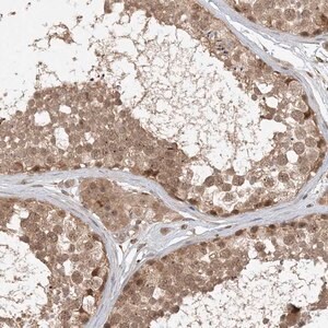 Merck Anti-ZCCHC4 antibody produced in rabbit