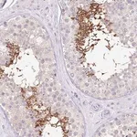Merck Anti-UBA6 antibody produced in rabbit