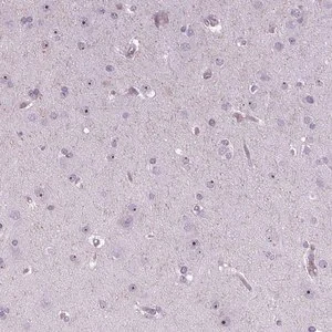 Merck Anti-NOLC1 antibody produced in rabbit