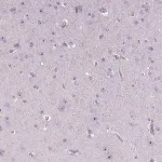 Merck Anti-NOLC1 antibody produced in rabbit