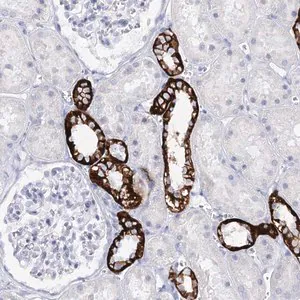 Merck Anti-SLC17A2 antibody produced in rabbit