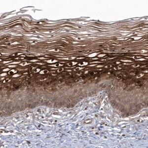 Merck Anti-ARMC8 antibody produced in rabbit