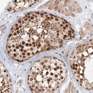 Merck Anti-R3HCC1L antibody produced in rabbit