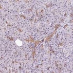 Merck Anti-ST7 antibody produced in rabbit