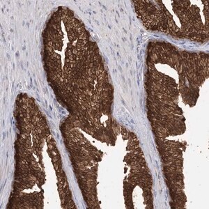 Merck Anti-R3HDM2 antibody produced in rabbit