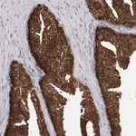 Merck Anti-R3HDM2 antibody produced in rabbit