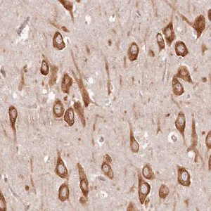 Merck Anti-TMIE antibody produced in rabbit