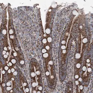 Merck Anti-UCN3 antibody produced in rabbit