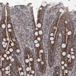 Merck Anti-UCN3 antibody produced in rabbit