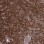 Merck Anti-TBC1D9B antibody produced in rabbit