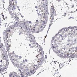 Merck Anti-ENOX1 antibody produced in rabbit