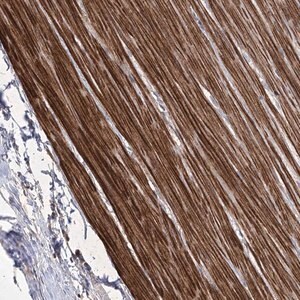 Merck Anti-WASHC3 antibody produced in rabbit