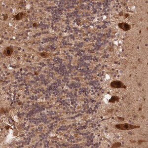 Merck Anti-VPS51 antibody produced in rabbit