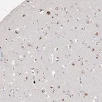 Merck Anti-ARSI antibody produced in rabbit