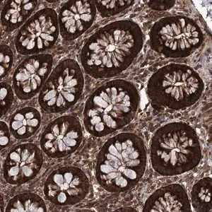 Merck Anti-DCP1B antibody produced in rabbit