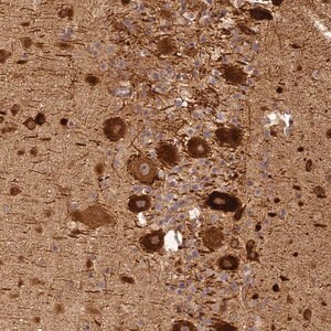 Merck Anti-BCDIN3D antibody produced in rabbit