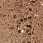 Merck Anti-BCDIN3D antibody produced in rabbit