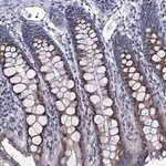 Merck Anti-ANKRD33 antibody produced in rabbit