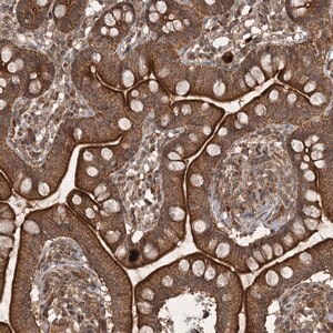 Merck Anti-UNC93A antibody produced in rabbit