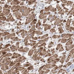 Merck Anti-PPP2R3A antibody produced in rabbit