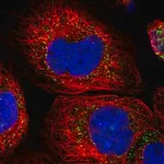 Merck Anti-ACOX3 antibody produced in rabbit