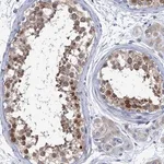 Merck Anti-SHE antibody produced in rabbit