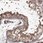 Merck Anti-THAP9 antibody produced in rabbit
