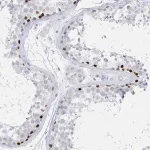 Merck Anti-TMCO6 antibody produced in rabbit