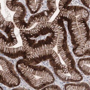 Merck Anti-METTL24 antibody produced in rabbit