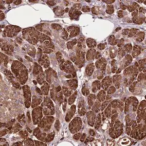Merck Anti-TARS antibody produced in rabbit