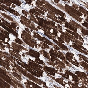 Merck Anti-CCSER2 antibody produced in rabbit