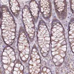 Merck Anti-ZFYVE27 antibody produced in rabbit