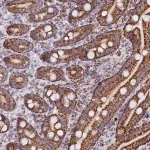 Merck Anti-C1D antibody produced in rabbit