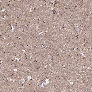 Merck Anti-ARHGAP20 antibody produced in rabbit