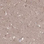 Merck Anti-ARHGAP20 antibody produced in rabbit