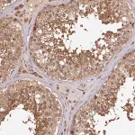 Merck Anti-TTC12 antibody produced in rabbit