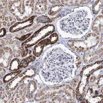 Merck Anti-UBASH3B antibody produced in rabbit