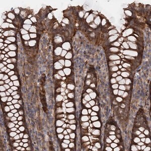 Merck Anti-ATP8B4 antibody produced in rabbit