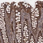 Merck Anti-ATP8B4 antibody produced in rabbit