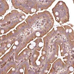 Merck Anti-RASSF1 antibody produced in rabbit