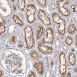 Merck Anti-ADCK2 antibody produced in rabbit